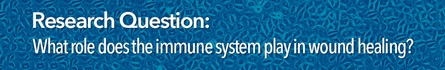 Research Question: What role does the immune system playin wound healing?